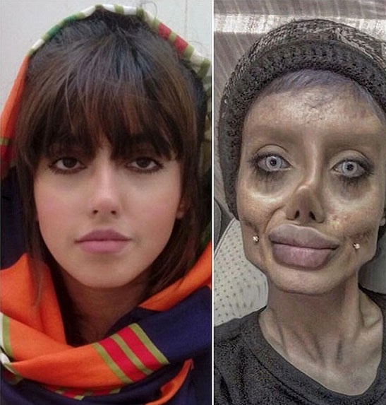 دختر ایرانی بالاخره شبیه آنجلینا جولی شد + عکس